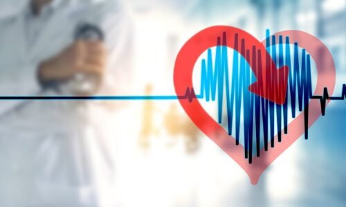 Stroke and Atrial Fibrillation